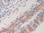 IL11RA Antibody in Immunohistochemistry (Paraffin) (IHC (P))