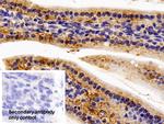 IL11RA Antibody in Immunohistochemistry (Paraffin) (IHC (P))