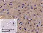 IL11RA Antibody in Immunohistochemistry (Paraffin) (IHC (P))