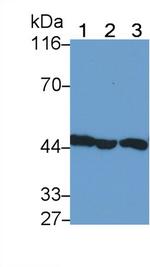 IL11RA Antibody in Western Blot (WB)