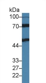 IL11RA Antibody in Western Blot (WB)