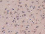 IL11RA Antibody in Immunohistochemistry (Paraffin) (IHC (P))