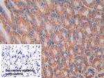 IL11RA Antibody in Immunohistochemistry (Paraffin) (IHC (P))