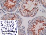 IL11RA Antibody in Immunohistochemistry (Paraffin) (IHC (P))