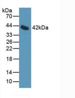 IL11RA Antibody in Western Blot (WB)