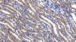 IL11RA Polyclonal Antibody