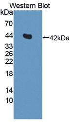 IL11RA Antibody in Western Blot (WB)