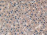 IL-25 Polyclonal Antibody