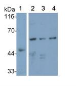 IL31RA Antibody in Western Blot (WB)