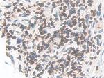 CD127 Antibody in Immunohistochemistry (Paraffin) (IHC (P))
