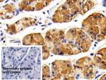 CD127 Antibody in Immunohistochemistry (Paraffin) (IHC (P))