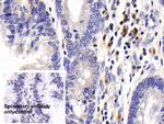 CD127 Antibody in Immunohistochemistry (Paraffin) (IHC (P))