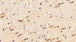 IBA1 Antibody in Immunohistochemistry (Paraffin) (IHC (P))