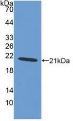 IBA1 Antibody in Western Blot (WB)