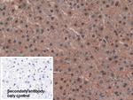 IDH1 Antibody in Immunohistochemistry (Paraffin) (IHC (P))