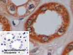 IDH1 Antibody in Immunohistochemistry (Paraffin) (IHC (P))