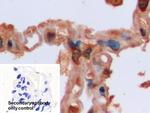 IDH1 Antibody in Immunohistochemistry (Paraffin) (IHC (P))