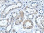 IARS Polyclonal Antibody