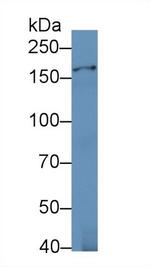 IARS Antibody in Western Blot (WB)
