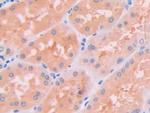 JAK2 Antibody in Immunohistochemistry (Paraffin) (IHC (P))