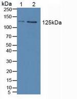 JAK2 Antibody in Western Blot (WB)