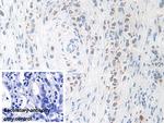 KLK11 Antibody in Immunohistochemistry (Paraffin) (IHC (P))