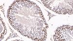 KPNA2 Antibody in Immunohistochemistry (Paraffin) (IHC (P))