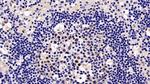 KPNA2 Antibody in Immunohistochemistry (Paraffin) (IHC (P))