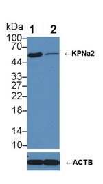 KPNA2 Antibody in Western Blot (WB)