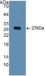 KPNA2 Antibody in Western Blot (WB)