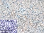 KATNA1 Polyclonal Antibody