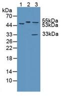 KATNA1 Antibody in Western Blot (WB)