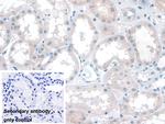 KATNA1 Polyclonal Antibody