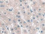 KATNA1 Antibody in Immunohistochemistry (Paraffin) (IHC (P))