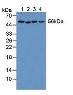 KATNA1 Antibody in Western Blot (WB)