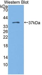 KAZALD1 Antibody in Western Blot (WB)