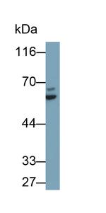 Cytokeratin 2e Polyclonal Antibody