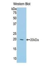 Cytokeratin 2e Antibody in Western Blot (WB)