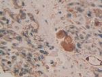Cytokeratin 3 Antibody in Immunohistochemistry (Paraffin) (IHC (P))