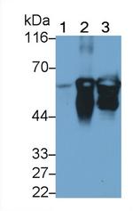 Cytokeratin 3 Antibody in Western Blot (WB)