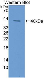 Cytokeratin 3 Antibody in Western Blot (WB)