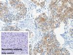 KRT33A Antibody in Immunohistochemistry (Paraffin) (IHC (P))