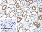 KRT33A Antibody in Immunohistochemistry (Paraffin) (IHC (P))