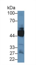 KRT33A Antibody in Western Blot (WB)