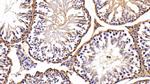 LDHB Antibody in Immunohistochemistry (Paraffin) (IHC (P))