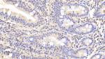 LDHB Polyclonal Antibody