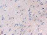 LTBP1 Antibody in Immunohistochemistry (Paraffin) (IHC (P))