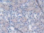 LTBP1 Antibody in Immunohistochemistry (Paraffin) (IHC (P))