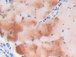 LTBP1 Antibody in Immunohistochemistry (Paraffin) (IHC (P))