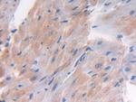 LTBP1 Antibody in Immunohistochemistry (Paraffin) (IHC (P))
